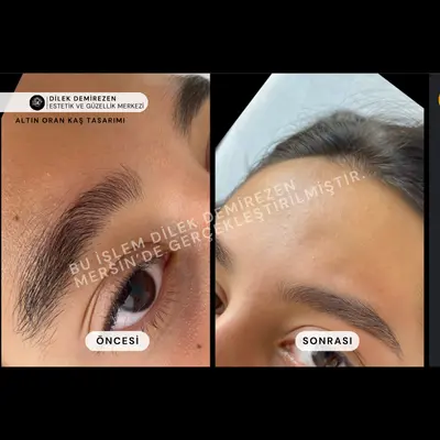 Kaş Tasarımı Öncesi Sonrası Mersin