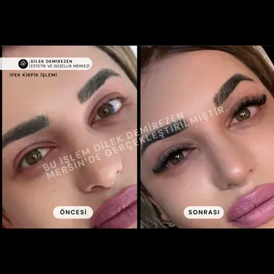 İpek Kirpik Öncesi Sonrası Mersin